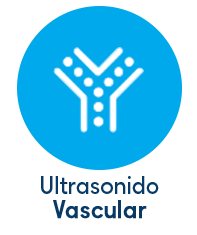 ultrasonido vascular